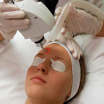 laser therapy image